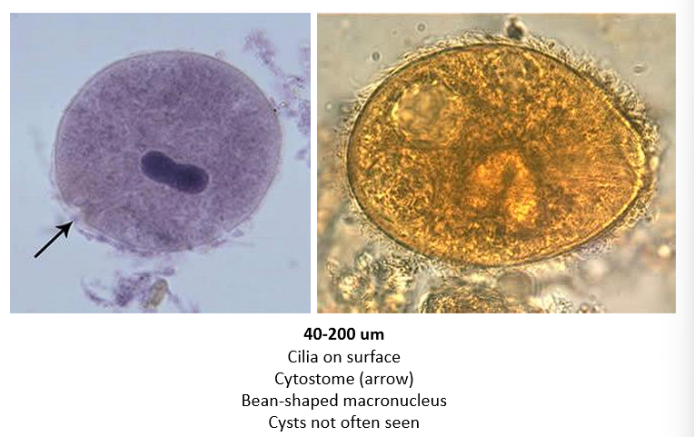 <ul><li><p>Cilia on trophozoite surface</p></li><li><p>Bean shaped macronucleus</p></li><li><p>Cysts not often seen</p></li></ul><p></p>