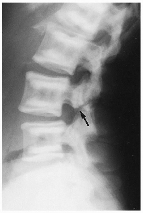 <p>What is the diagnosis?</p>