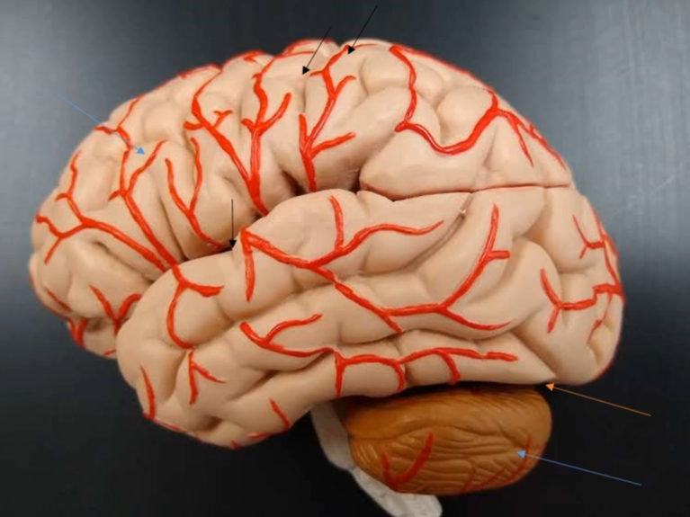 <p>What is the name of the fissure that separate the cerebrum and cerebellum (orange arrow))?</p>