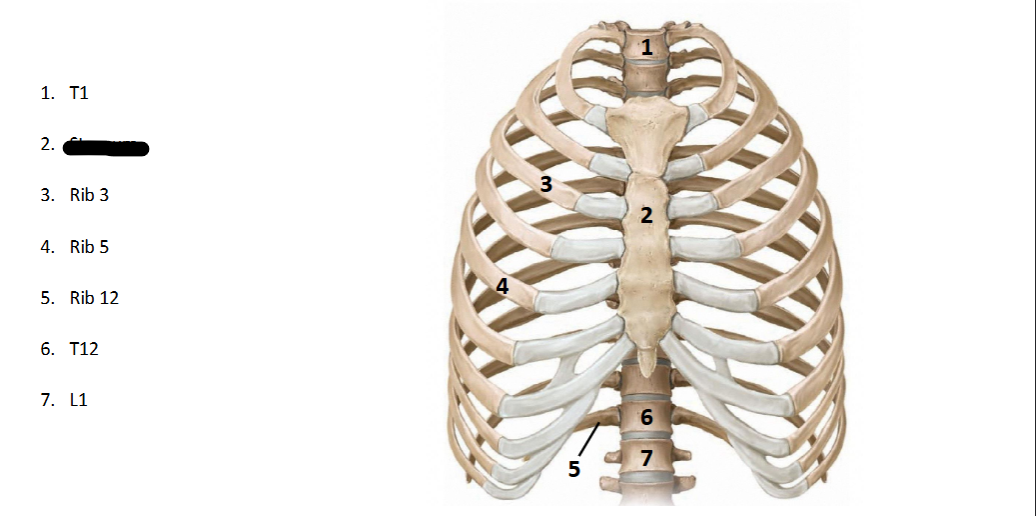 <p>What structure is this within the <strong>Spine? (ANTERIOR OF AXIAL)</strong></p>