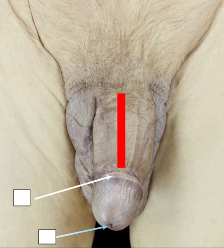 <p>Identify</p><p>Side Question:</p><p>The deep type of this structure drains blood from and into?</p><p>The superficial type of this structure drains blood from?</p><p>This lies between which structure?</p><p>This structure is accompanied by?</p>