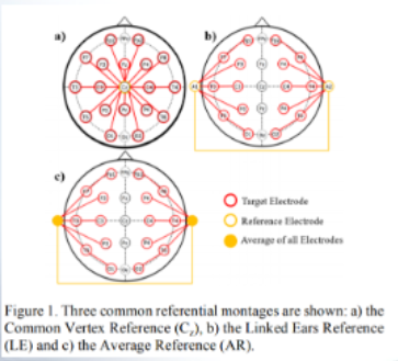 <p>Each channel is the difference between an “active electrode” and the average of all electrodes.</p>