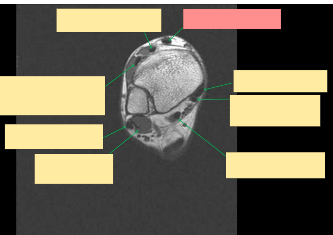 <p>Identify this structure</p>