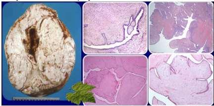 <p>What pathology?</p>