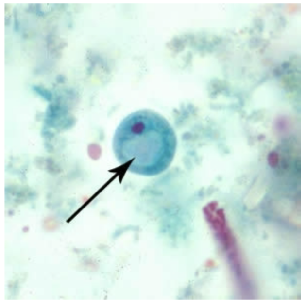 <p>-No peripheral chromatin</p><p>-Prominent vacuole</p>