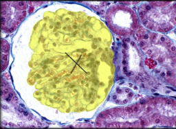 <p>identify the structure highlighted and marked with an X in the image below.</p>