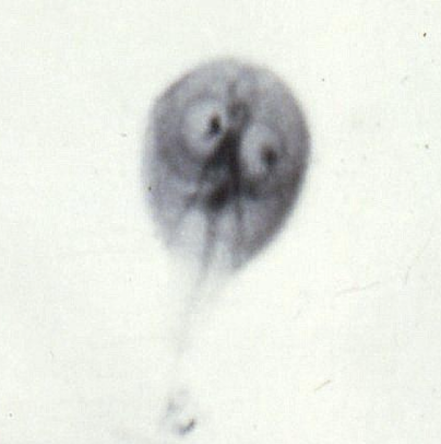 <p>What flagellate is this?</p>