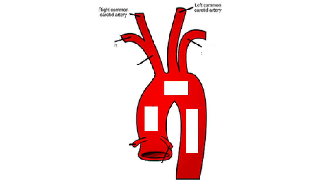 <p></p><p></p><p>These arteries supply blood to the head and neck. The left common carotid artery branches directly from the aorta, while the right arises from the brachiocephalic trunk. </p>