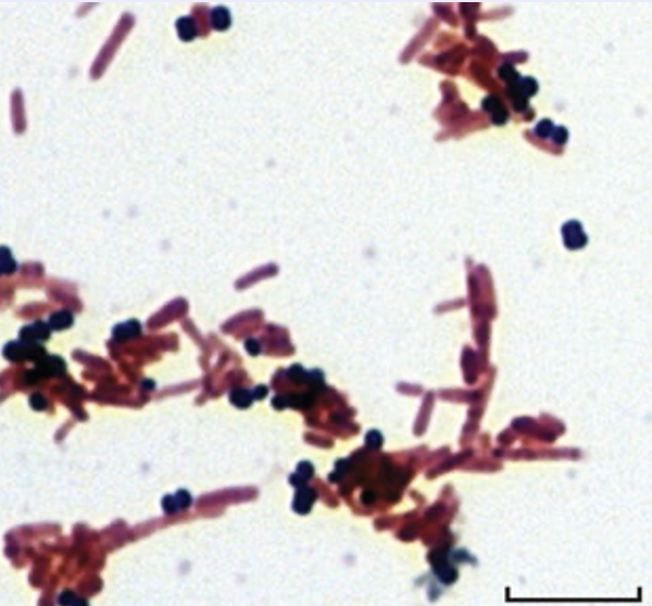 <p>What kind of stain is this?</p>
