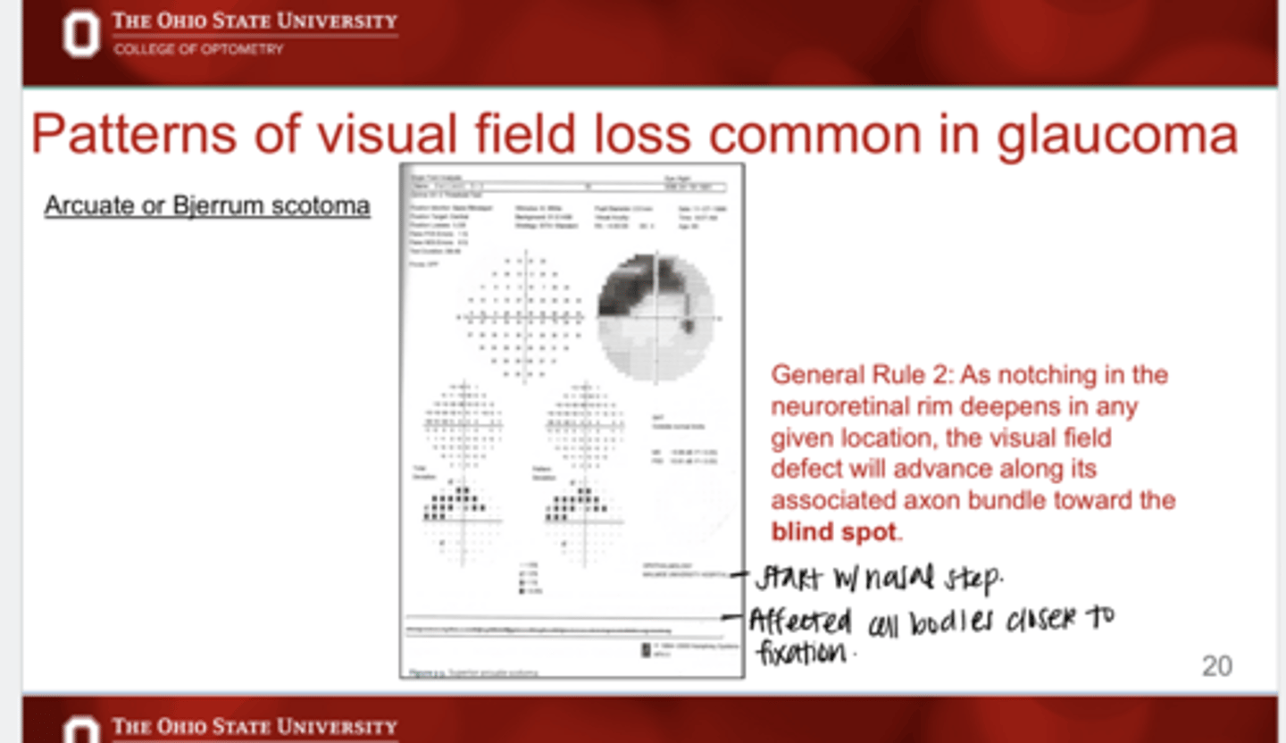 <p>As notching of the reuroretinal rim deepens in any given location, the VF defect will advance where?</p>