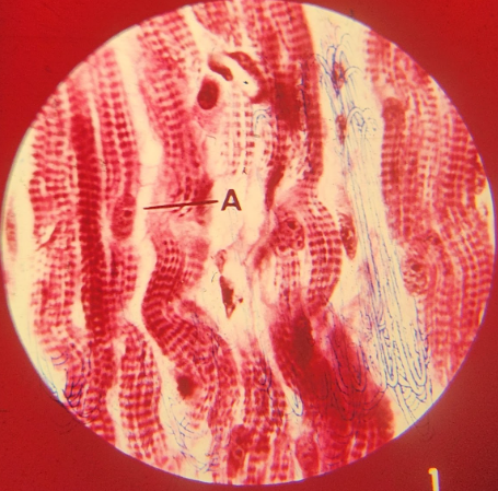 term image