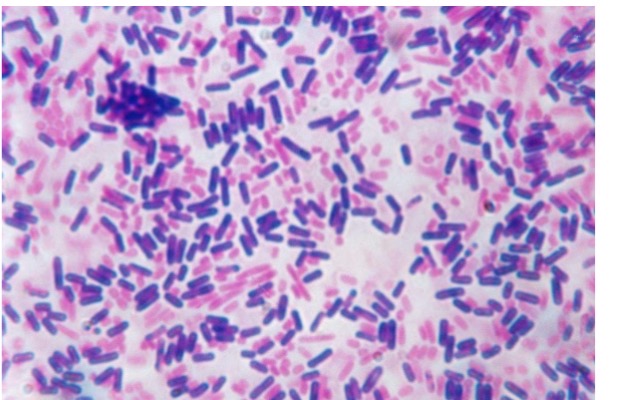 <p>Brightfield microscopy</p>