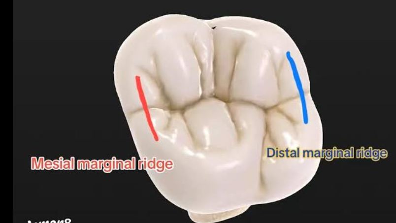 <p>rounded borders on mesial/distal margins occlusal surfaces of premolars and molars as well as mesial/distal margins of lingual surfaces of incisors and canines</p>