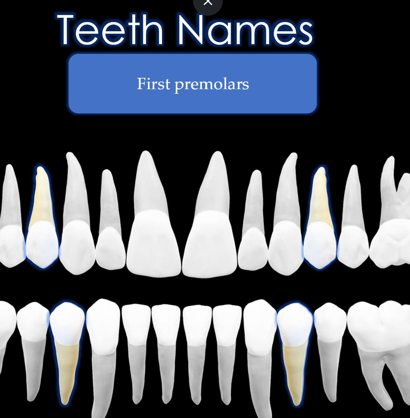 <p>Teeth #: 5,12, 21, 28</p>