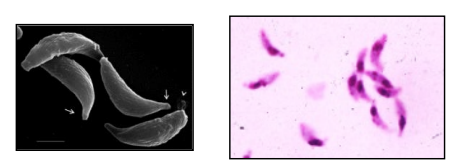 <p>Identifique e cite uma forma de transmissão </p>
