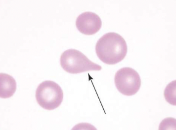 <p>name the type of RBC</p>