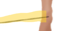 <p>What term is this? </p>
