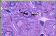<p>Identify the following structures in electron micrograph (#1; whole structure)</p>