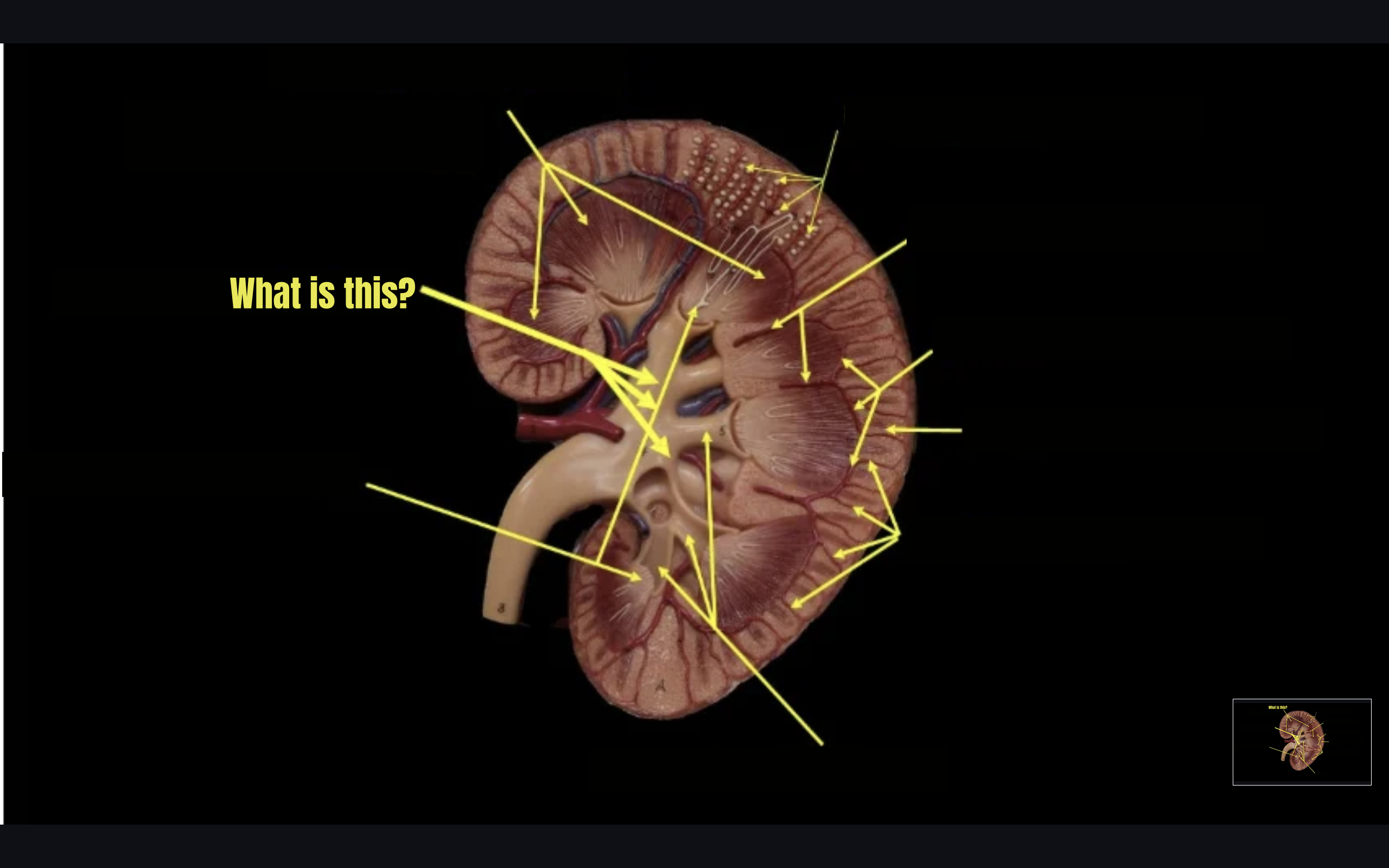 term image