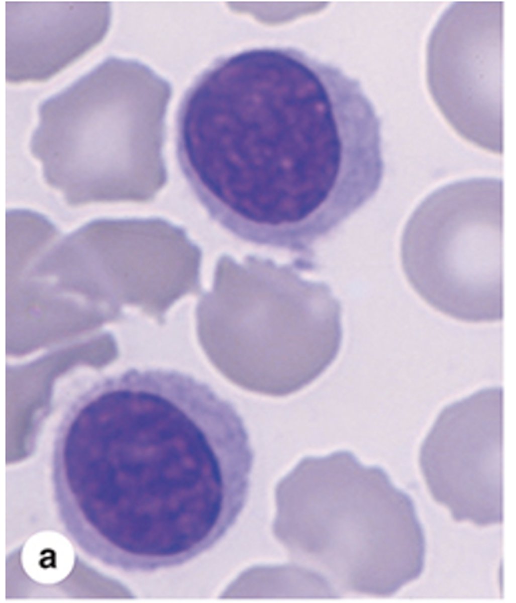 <p>What type of chromatin do small lymphocytes have?</p>