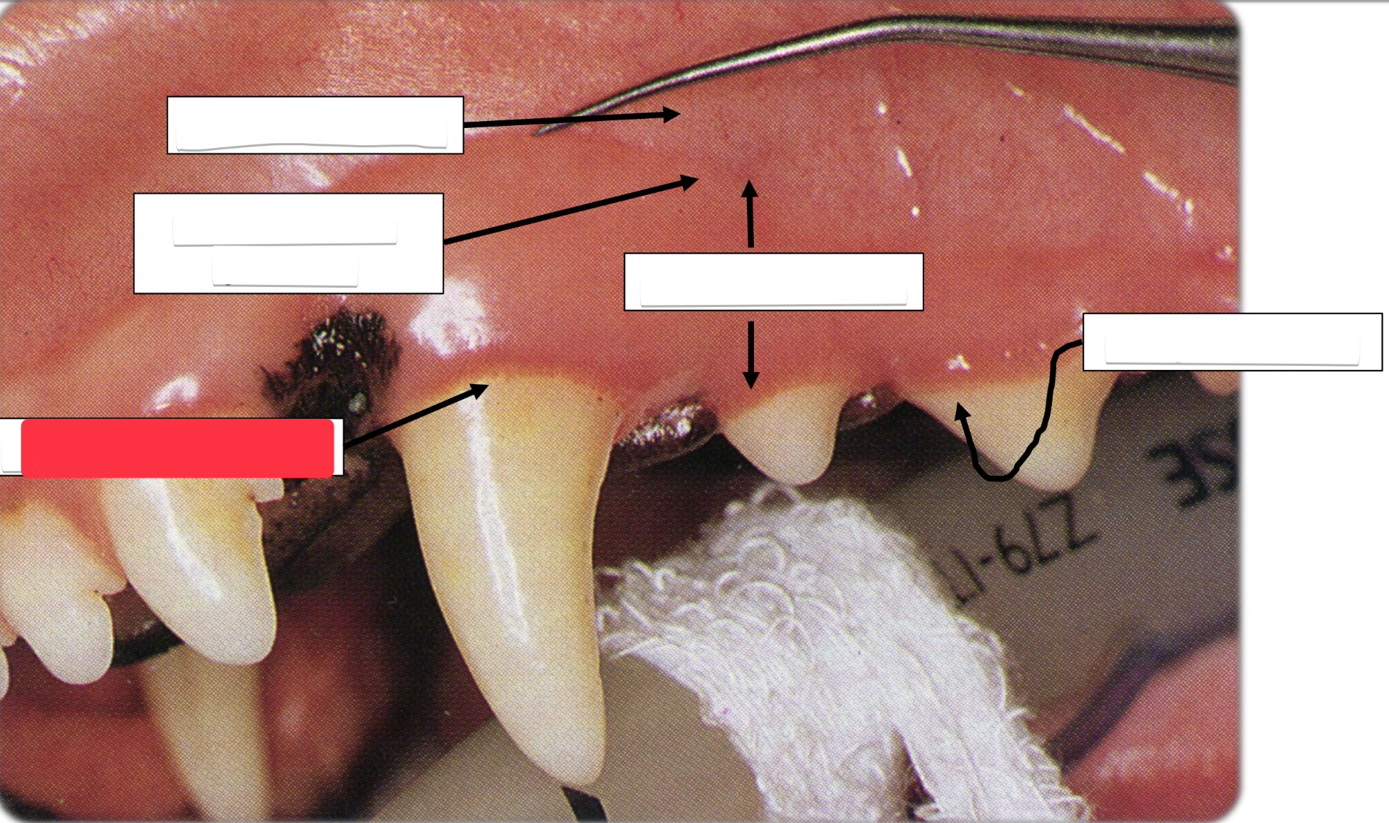<p>Label this part of the gingiva.</p>