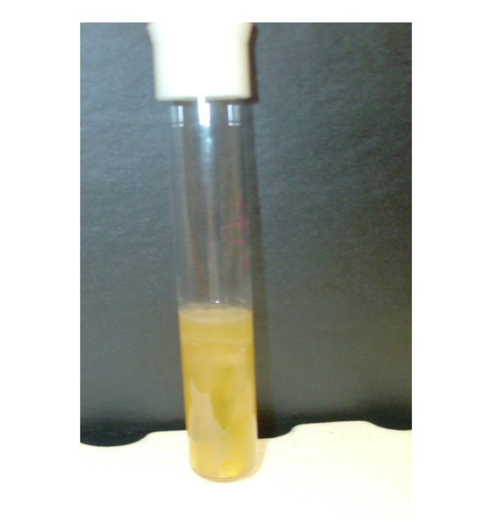 <p>what is the test and result?</p>