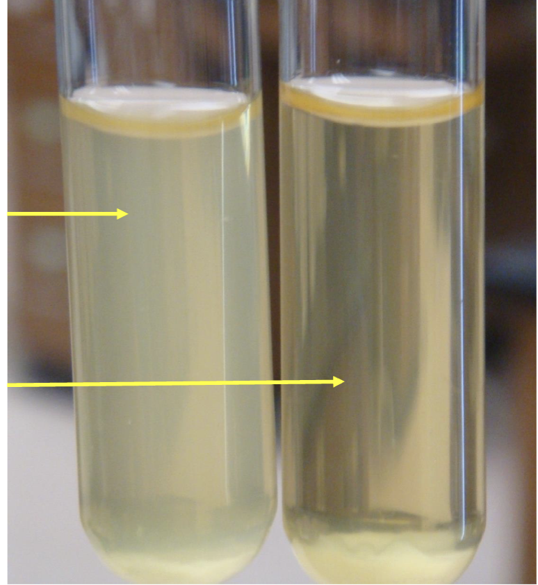 <p>whats the left line?</p>