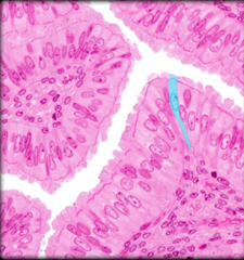 <p>Identify the highlighted structure</p>