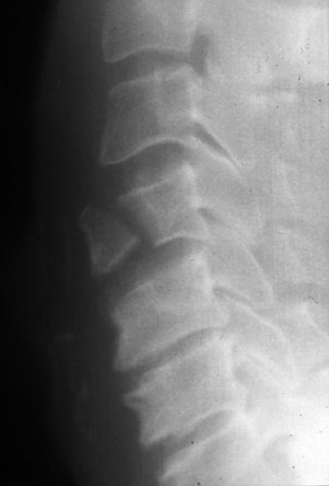 <p>What is the diagnosis?</p>