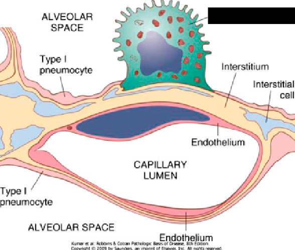 <p><span style="background-color: transparent;">Cells in the alveoli that secrete a substance known as <strong>surfactant</strong> that helps to decrease tension in the alveoli.</span></p>