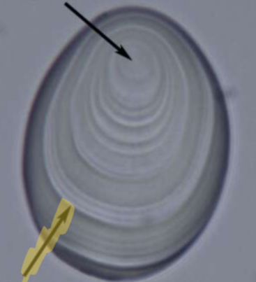 <p>Identify the feature of the highlighted arrow</p>