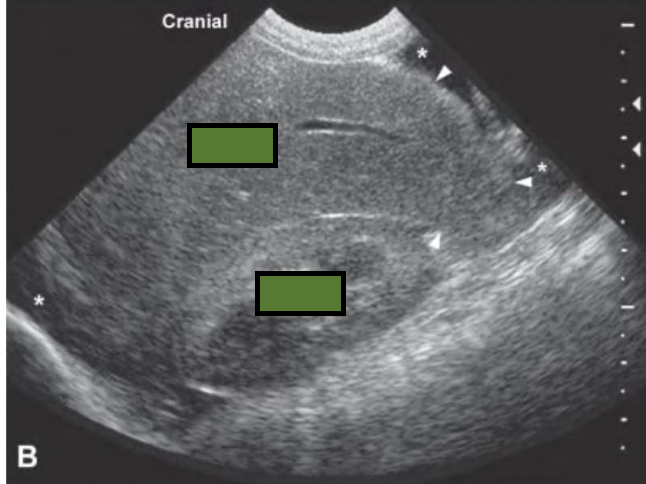<p>what is occurring in the following ultrasound?</p>