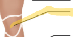 <p>What term is this? </p>