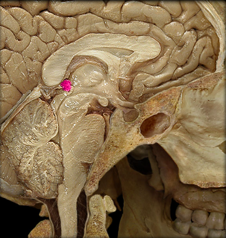 term image