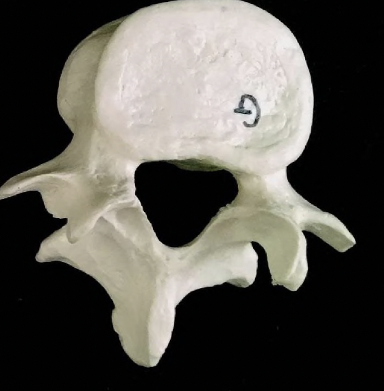 <p>what vertebrae is this?</p>