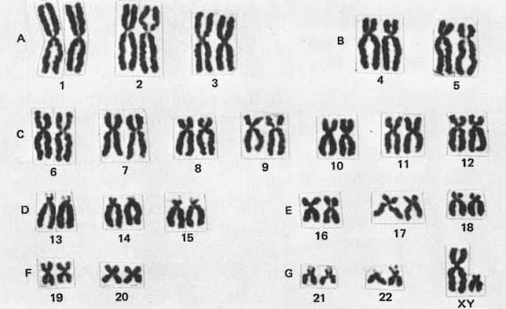 <ul><li><p>Somatic cells have 46 chromosomes</p><ul><li><p> 23 homologous pairs </p><ul><li><p>22 autosomes</p></li><li><p>1 sex-determining pair</p></li></ul></li></ul></li><li><p>Gametes have 23</p></li></ul><p></p>