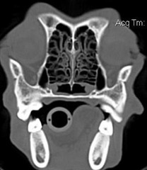 <p>Is this normal or abnormal?</p>