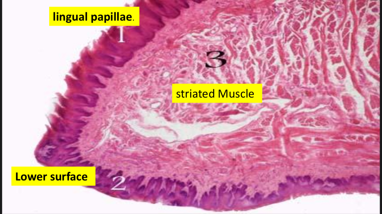 term image