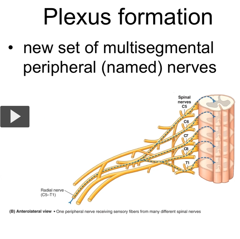 <p>In this other example, we have one peripheral nerve receiving the sensory fibers from many different spinal nerves </p>
