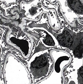 <p>1. Following paraformaldehyde fixation, what secondary fixative is used for the image shown? </p><p>2. Why is this secondary fixative used? </p><p>3. Identify the tissue shown.</p>