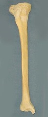 <p>Identify the Bone</p>