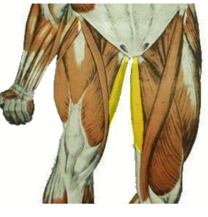 <p>What muscle is being highlighted?</p>