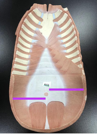 <p>transversus abdominis</p>