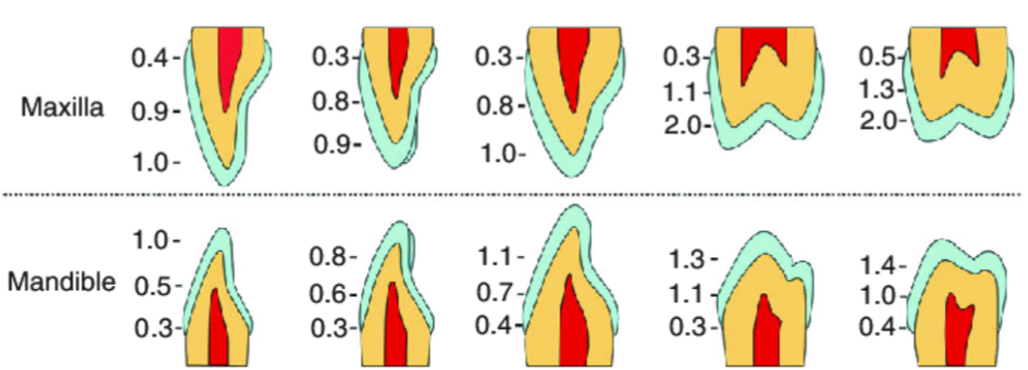 <p>Where is enamel thinner?</p>