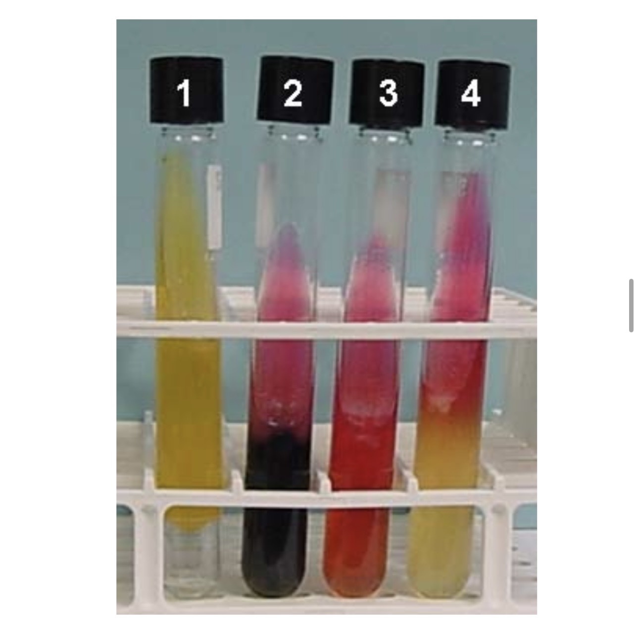<p>A. What series of tests are shown above?</p><p>B. What does Tube 2 indicate?</p>