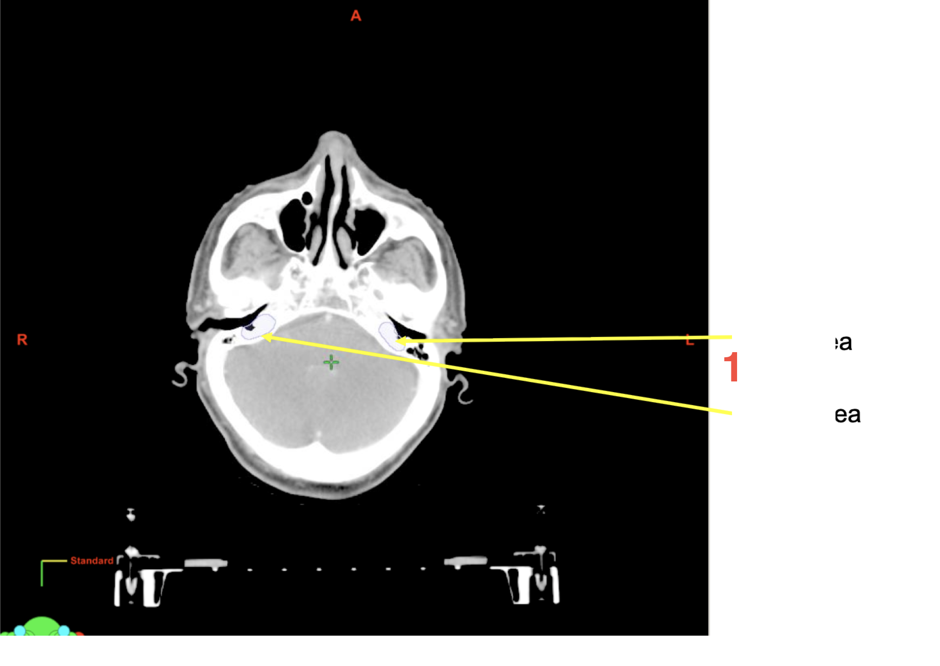 <p>1</p>