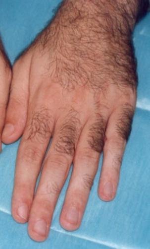 <p>vellos de la mano</p>