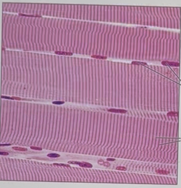 <p>Identify the SPECIFIC tissue type (NOT epithelial/connective/muscle/nervous categories) shown in the image below.</p>