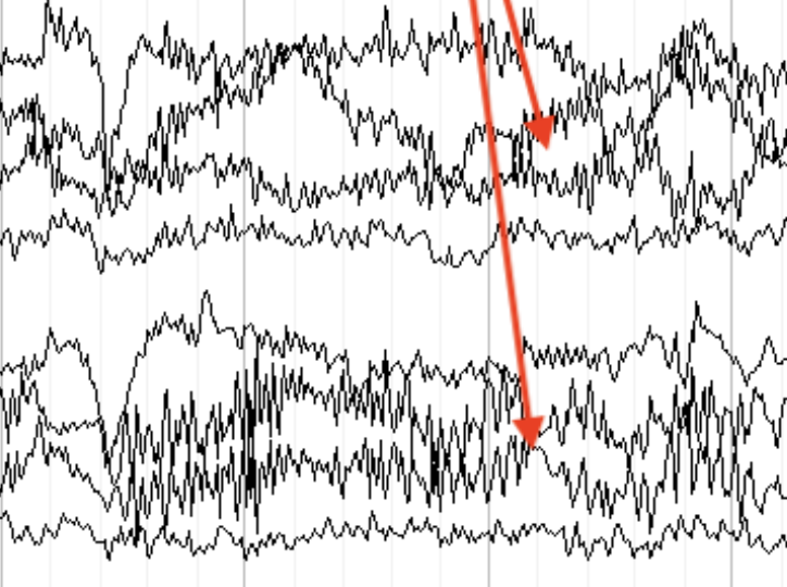 <p>Diffuse delta frequency + organized btw</p>