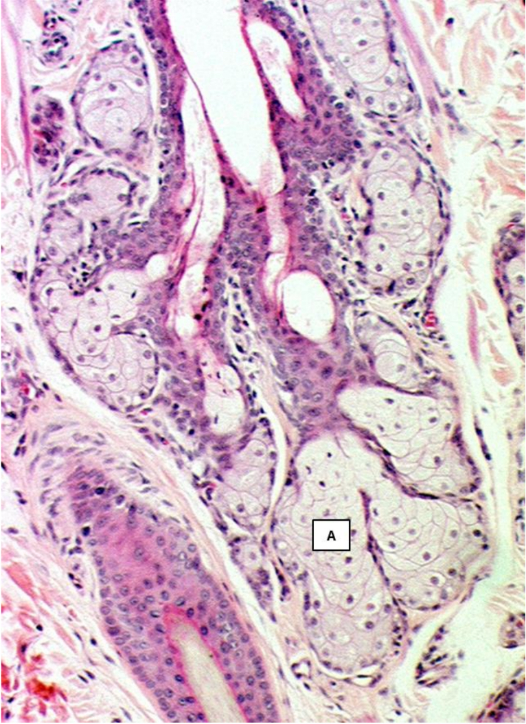 <p>What type of glands are indicated by A?</p>